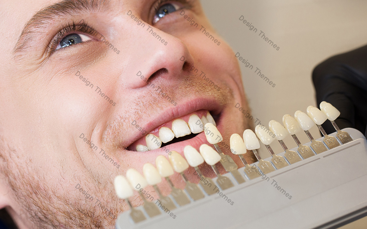 Dental Bridges Dental Bridges